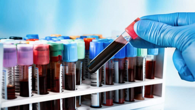 BioStem: созданной бывшими автогонщками медицинской компании предсказали трехкратный рост