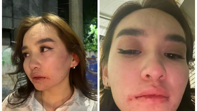 Алматинку жестоко избили за отказ познакомиться. В полиции ей сказали, что она сама виновата