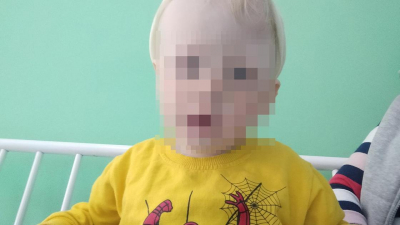 &quot;Голова необычной формы&quot;: мальчику из Жамбылской области нужна операция за границей
